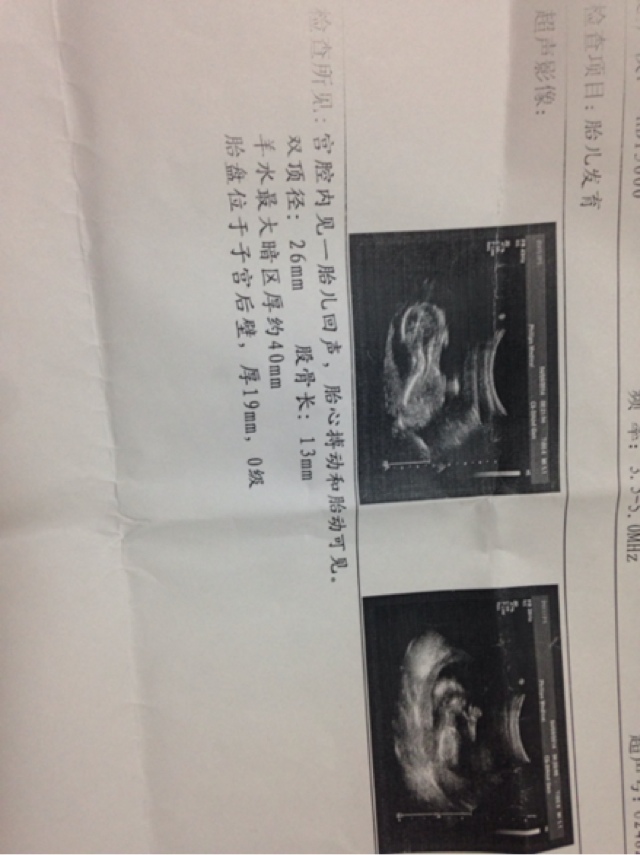 外媒:巴勒斯坦要切断与以色列及美国的一切关系【熊猫体育首页】(图2) 熊猫体育